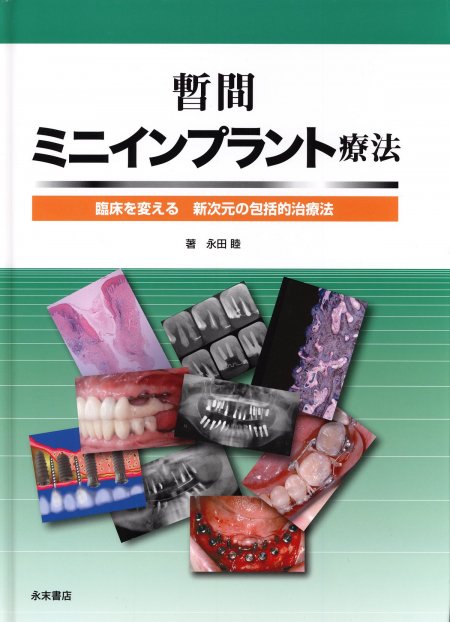 暫間ミニインプラント療法｜株式会社インプラテックスの取扱い商品